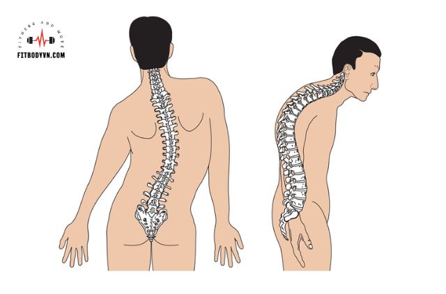 bi-veo-cot-song-co-nen-tap-gym-1.jpg